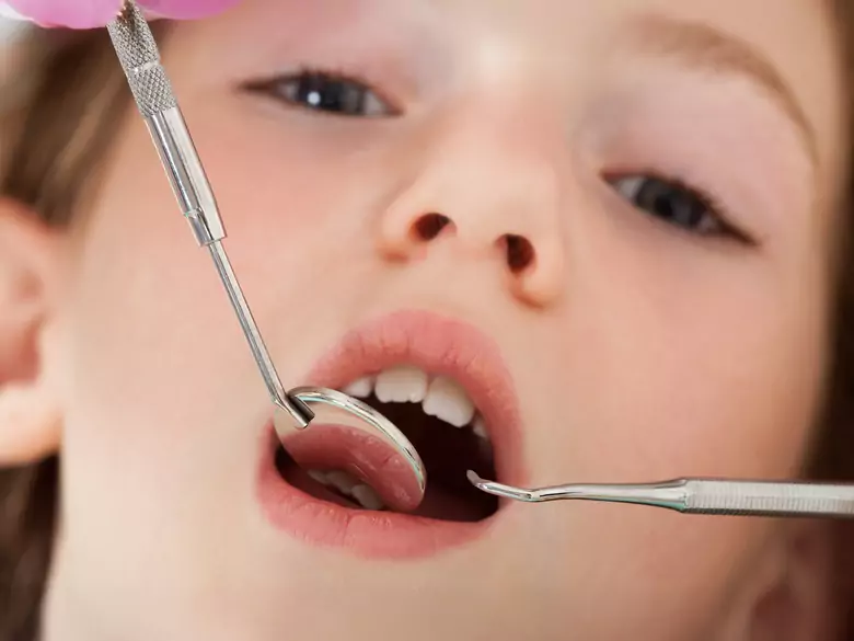 Migdałki podniebienne u dzieci - przyczyny, objawy, diagnoza, leczenie